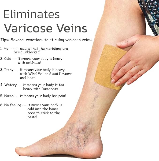 رقعة علاج الأوردة