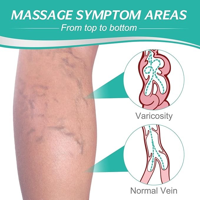 رقعة علاج الأوردة