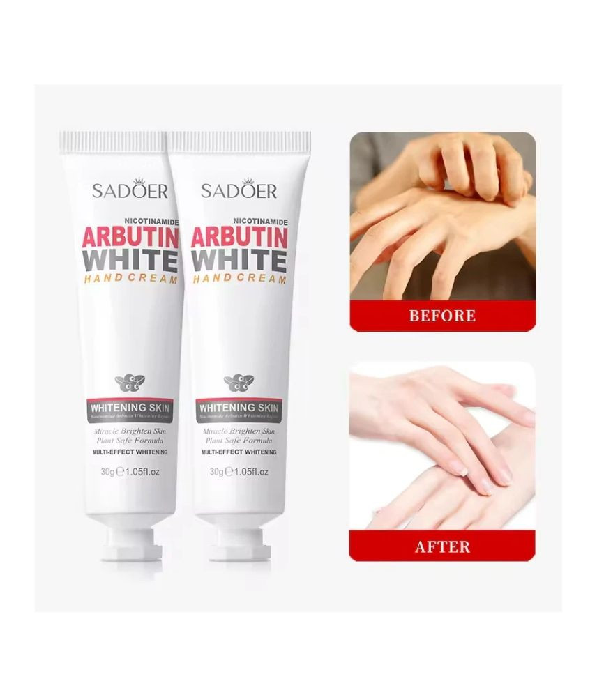 كريم اليدين سادوير بالنياسيناميد والأربوتين للتفتيح