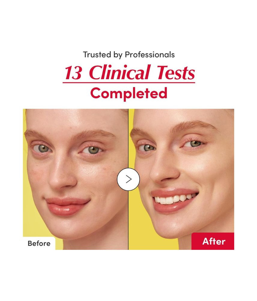 سيروم إيكوال بيري فيتامين إلومينيتينج