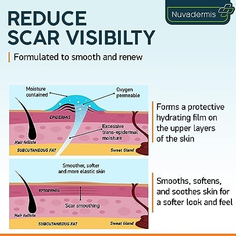 جل كريم الندبات