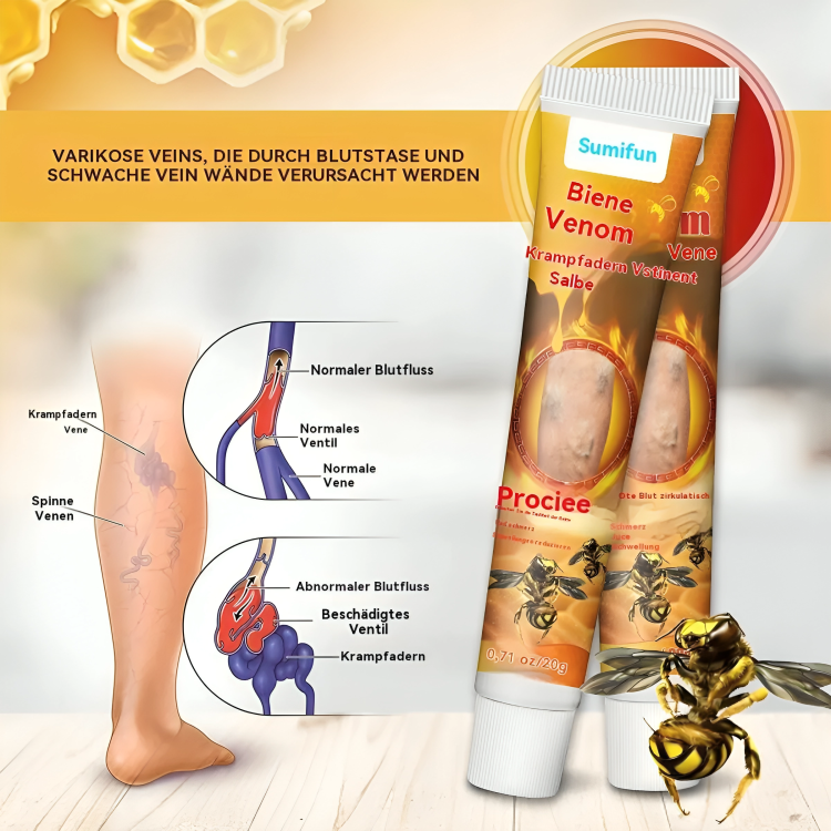 لوشن استرخاء للساقين والعضلات بسم النحل