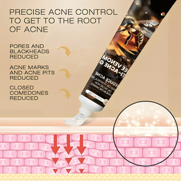 جل سم النحل المضاد لحب الشباب