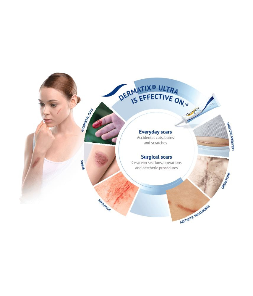 درماتيكس ألترا جل 15 جم