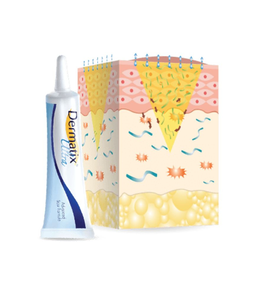 درماتيكس ألترا جل 15 جم