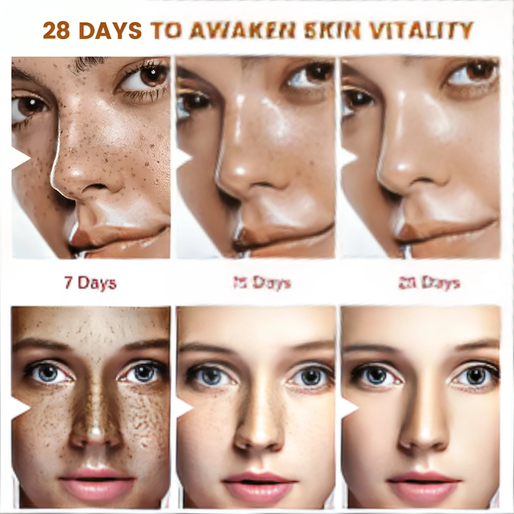 كريم ولوشن لعلاج الكلف للوجه بسم النحل