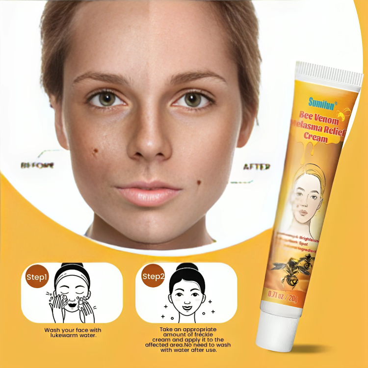 كريم ولوشن لعلاج الكلف للوجه بسم النحل