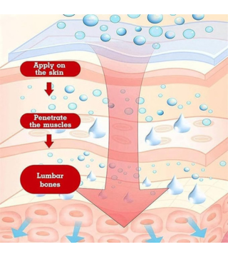 بخاخ لتخفيف آلام الركبة