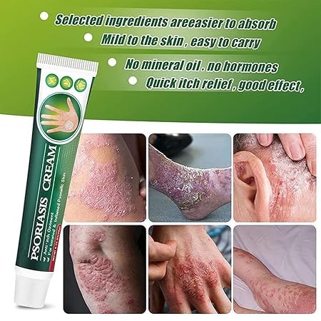 كريم الصدفية SkinMedix