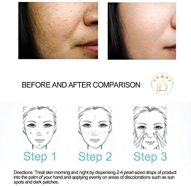 سيروم دكتور راشيل لتفتيح البشرة وإزالة البقع الداكنة