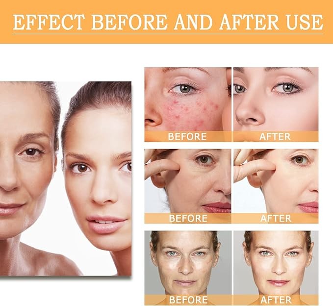 محلول التنغيم بحمض الجليكوليك 7%