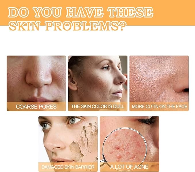 محلول التنغيم بحمض الجليكوليك 7%