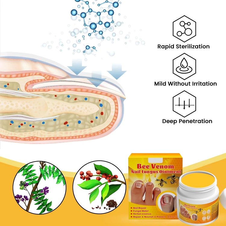 كريم علاج فطريات أظافر القدم بسم النحل