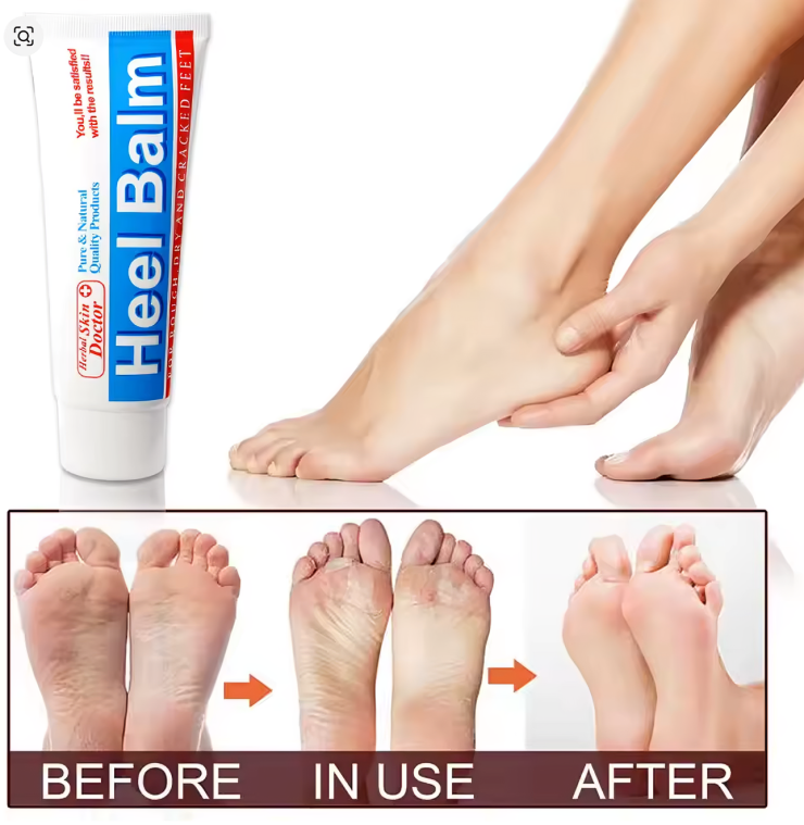 كريم عشبي لإصلاح الأقدام الجافة والمشققة