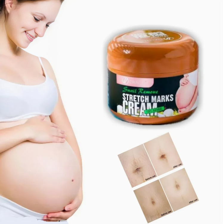 كريم إزالة علامات التمدد من الحلزون