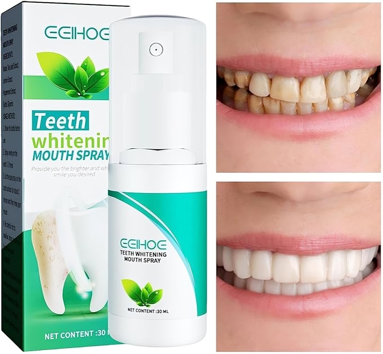 بخاخ لتفتيح الاسنان ورائحة الفم