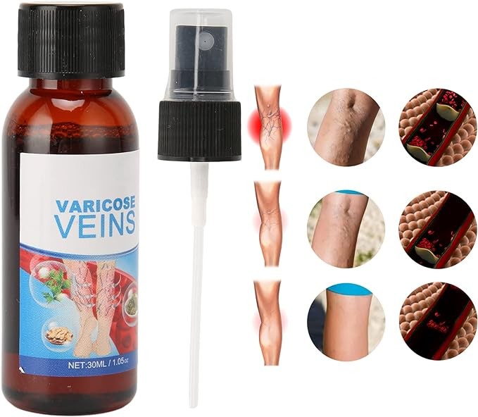 رذاذ للدوالي