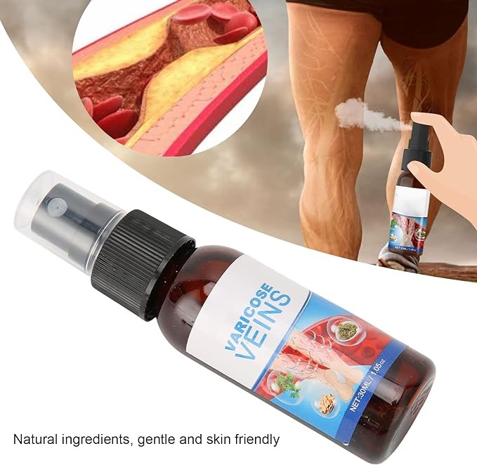 رذاذ للدوالي