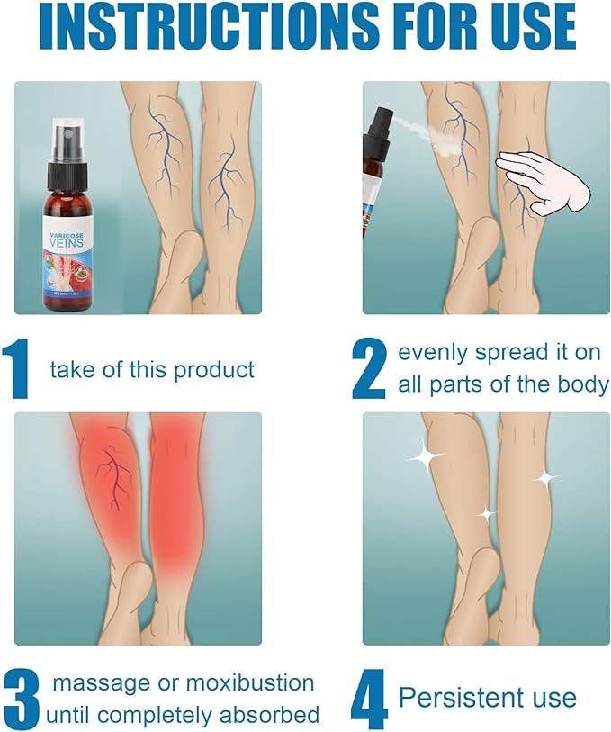 رذاذ للدوالي