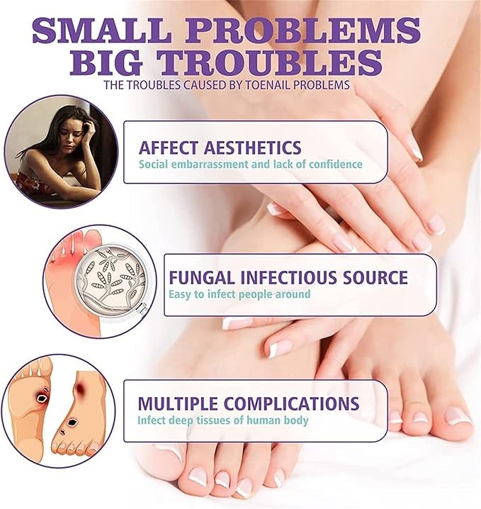 رذاذ أظافر القدمين