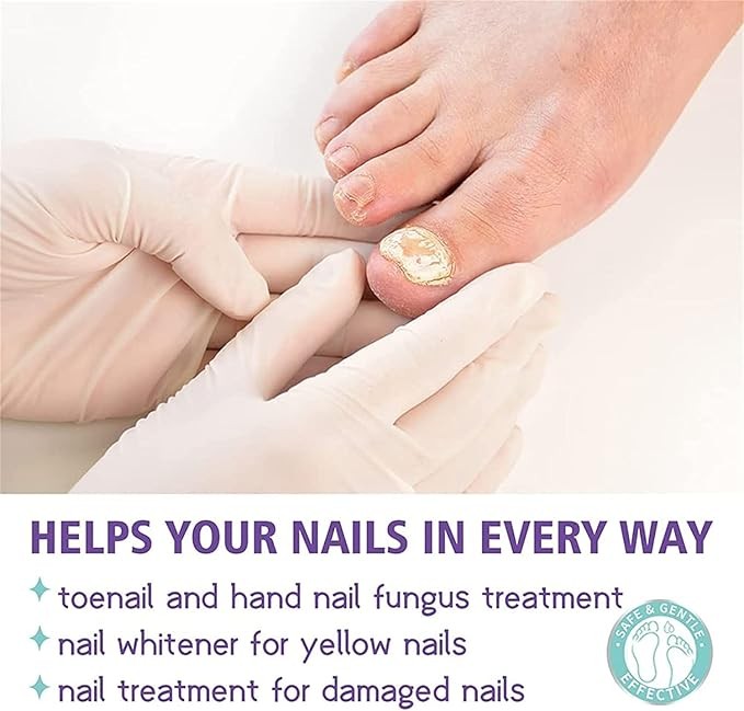 رذاذ أظافر القدمين