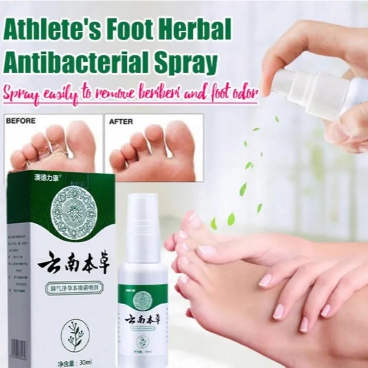 كريم مضاد للجراثيم كريم قدم رياضي