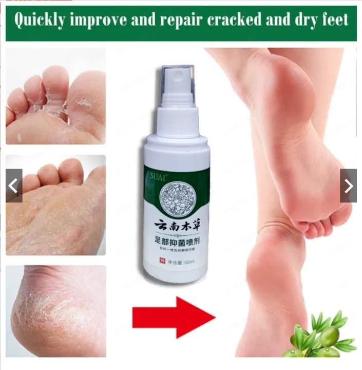 كريم مضاد للجراثيم كريم قدم رياضي