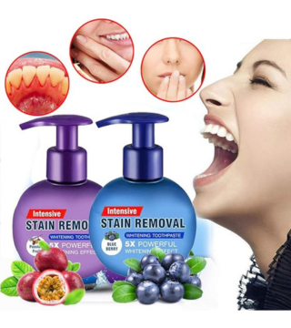 معجون صودا الخبز لتبييض الأسنان