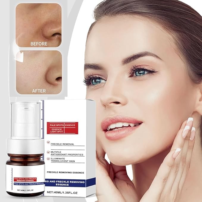 سيرم اوبينز للبقع