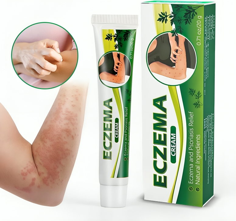كريم علاج التهاب الجلد والصدفية والأكزيما