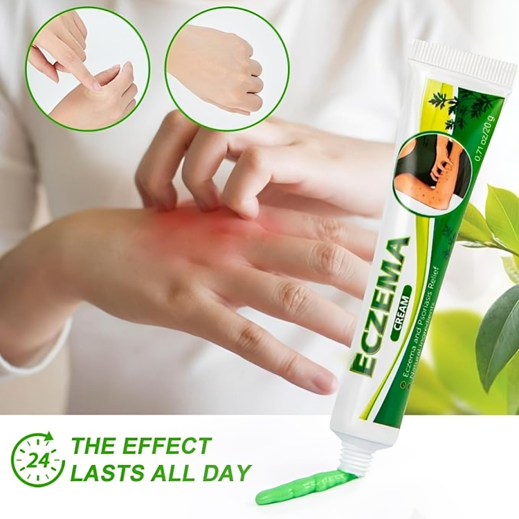 كريم علاج التهاب الجلد والصدفية والأكزيما