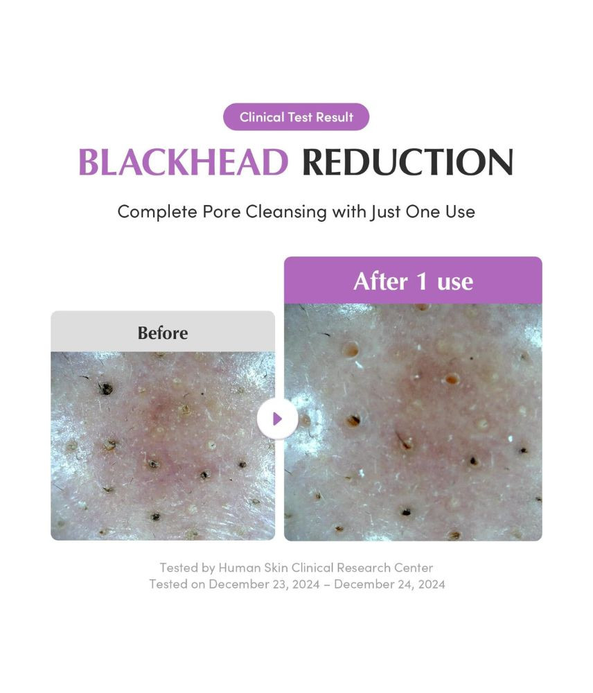 منظف ومقشر مسام البشرة بخلاصة الأرز البنفسجي من إيكوالبيري