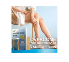 تصحيح الدوالي الصحية