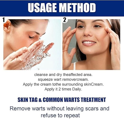 مرهم إزالة الزوائد الجلدية