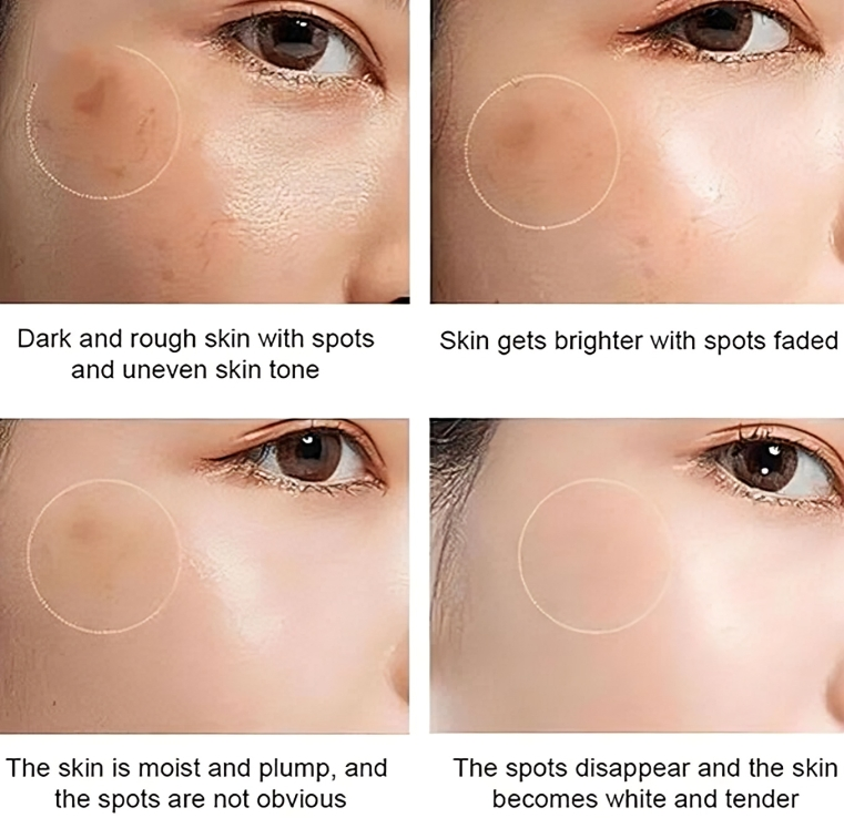 كريم إزالة البقع الداكنة والميلانين