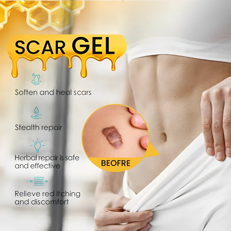 جل علاج الندبات وإزالة علامات التمدد