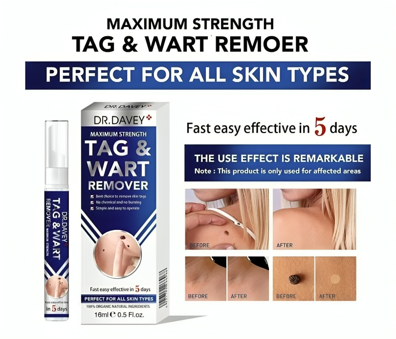 كريم مزيل للزوائد الجلدية والعلامات