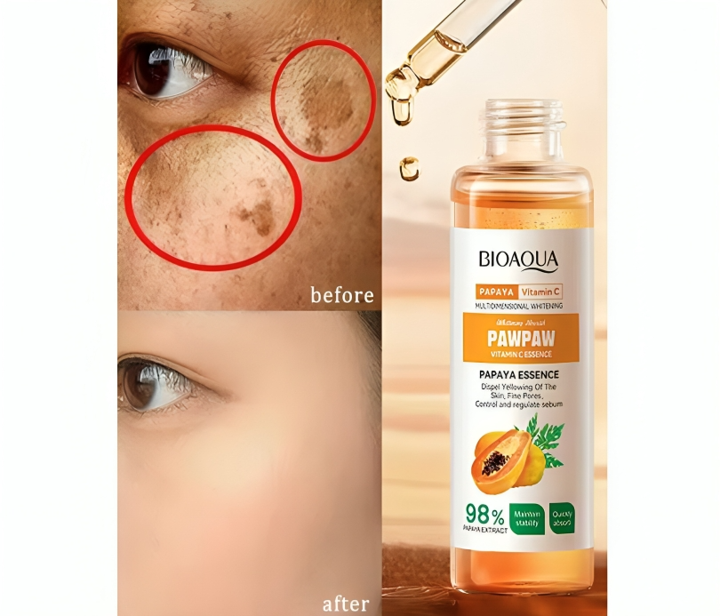 سيروم البابايا للبقع الداكنة