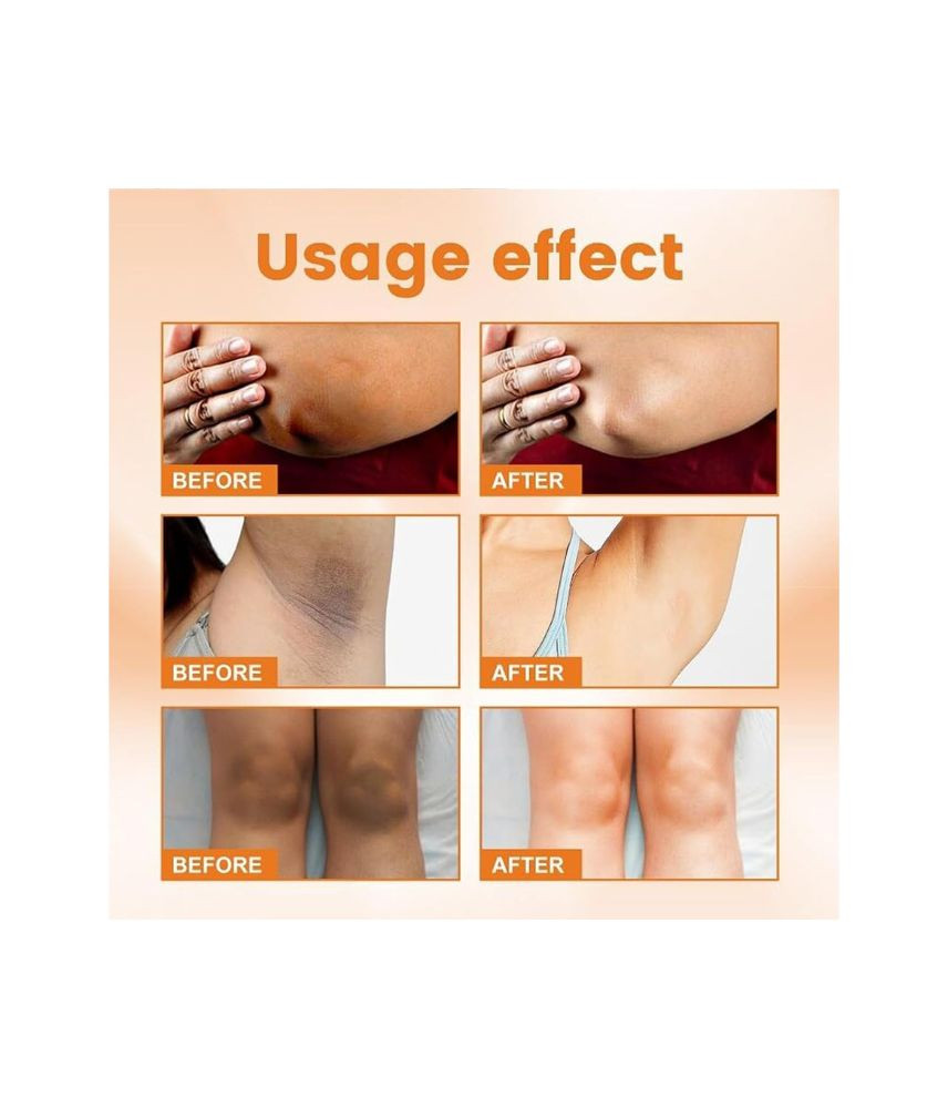 كريم تبييض المناطق الداكنة بفيتامين C من SADOER