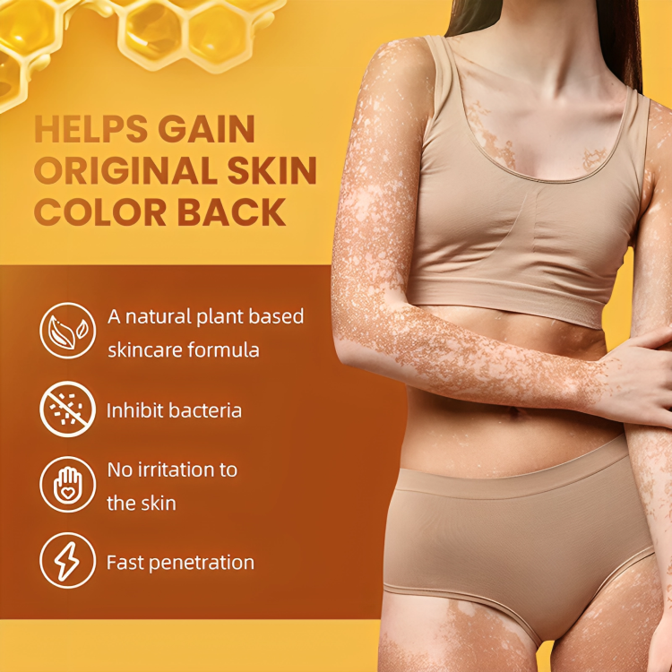 مرهم البهاق الاصفر للعناية بالبشرة