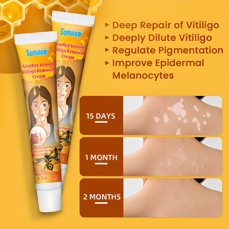 مرهم البهاق الاصفر للعناية بالبشرة