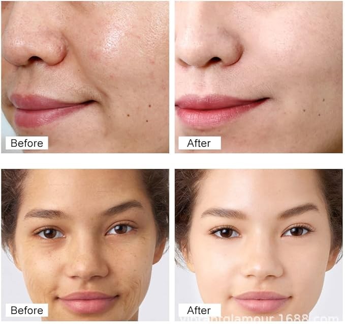 كريم الريتينول للوجه