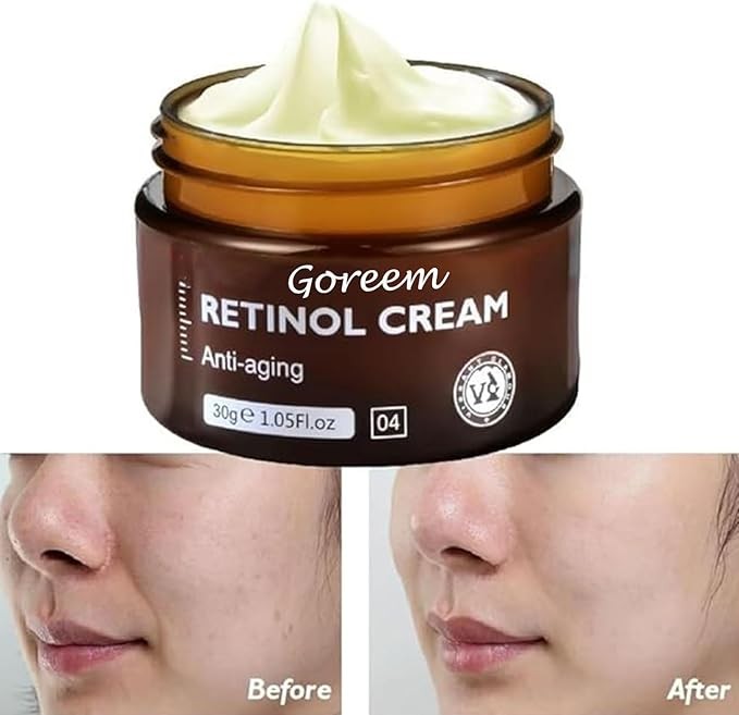كريم الريتينول للوجه