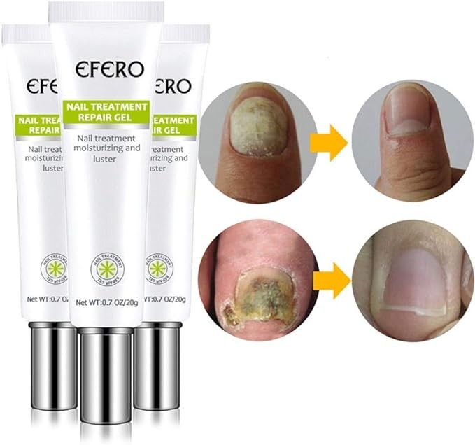 جل إصلاح علاج الأظافر