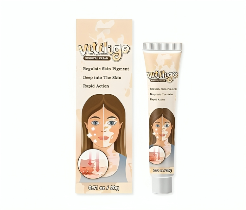 كريم علاج البهاق والبقع البيضاء