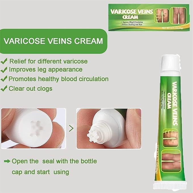 كريم علاج الدوالي