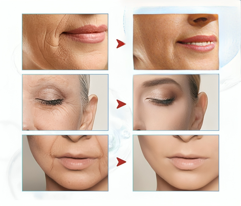 سيروم شد الوجه وعلاج الشيخوخة للنساء