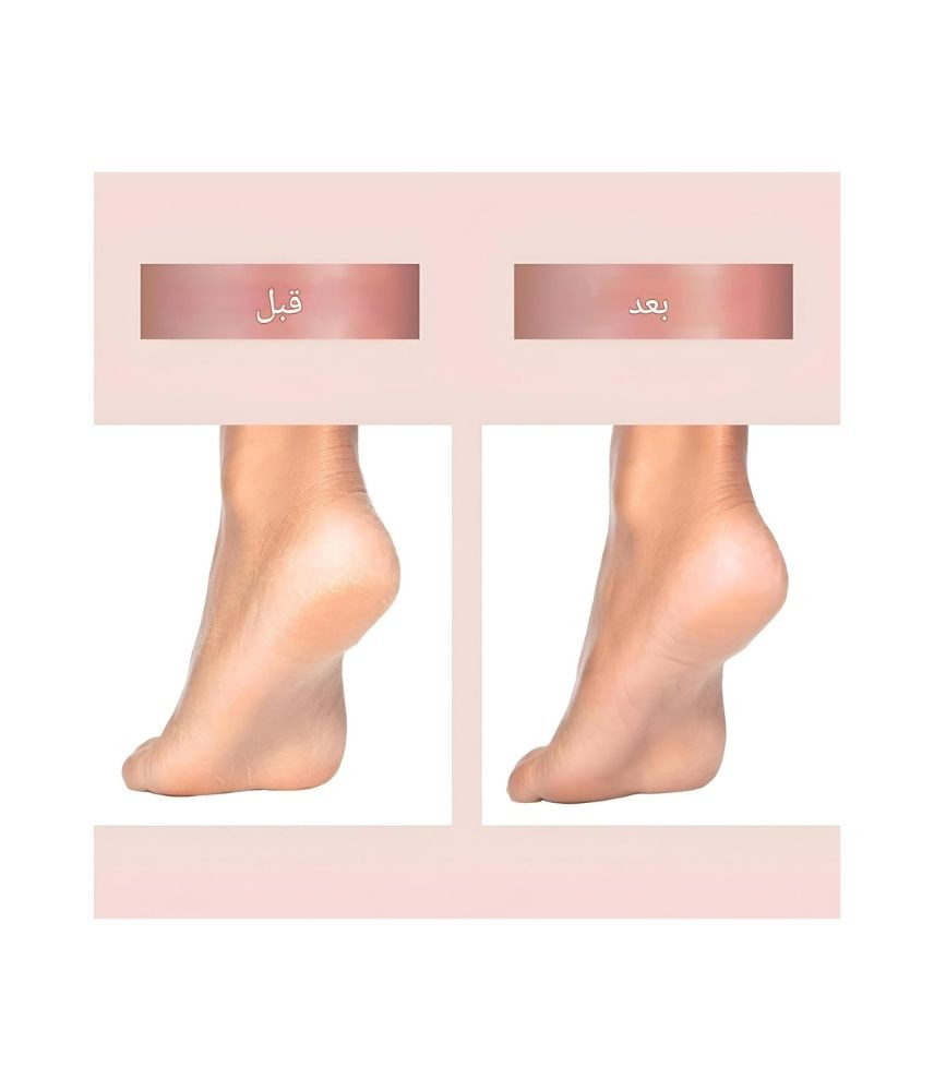 أداة باديكير كهربائية قابلة لإعادة الشحن لإزالة الجلد الميت T