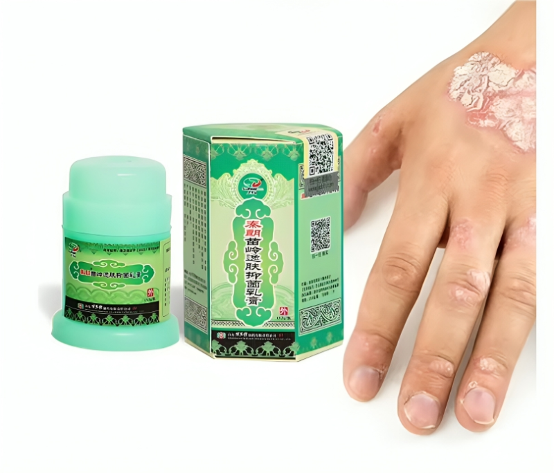 كريم علاج الأكزيما الأخضر