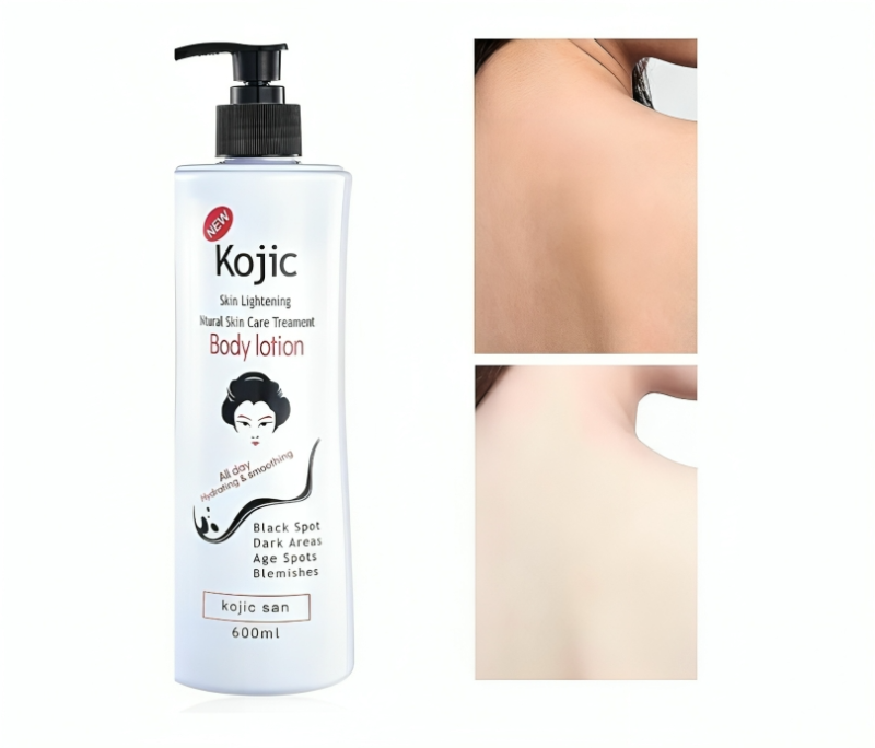 لوشن كوجيك لتفتيح البشرة والبقع الداكنة